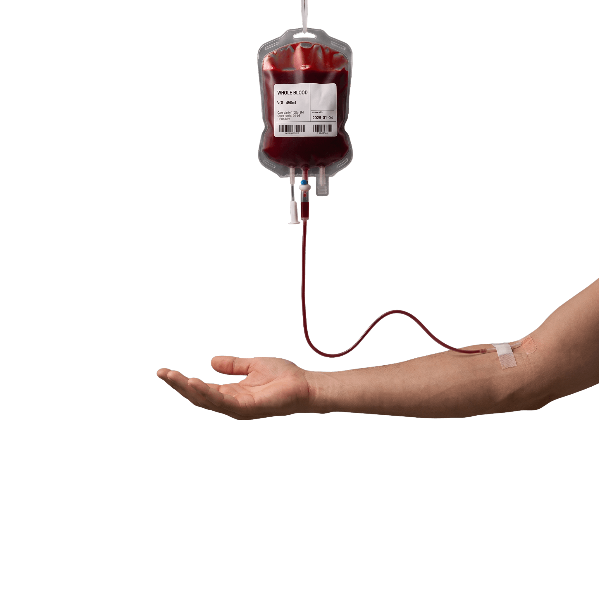 An arm connected by a donation line to a blood bag